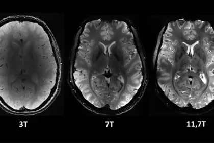 L'IRM la plus puissante au monde, Iseult, capture les premières images sans précédent du cerveau humain