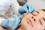Le botox pour prévenir les rides , une pratique qui séduit de plus en plus tôt
